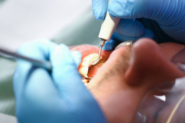 Best Emergency Dentist for Knocked-Out Tooth in Lyndhurst, VA
