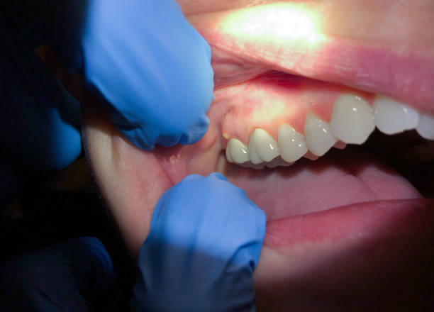 Best Emergency Dental Services for Seniors in Lyndhurst, VA